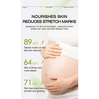 Picture of MOIKA Antipregnancy Wrinkle & Stretch Mark Removal Cream 50Gm