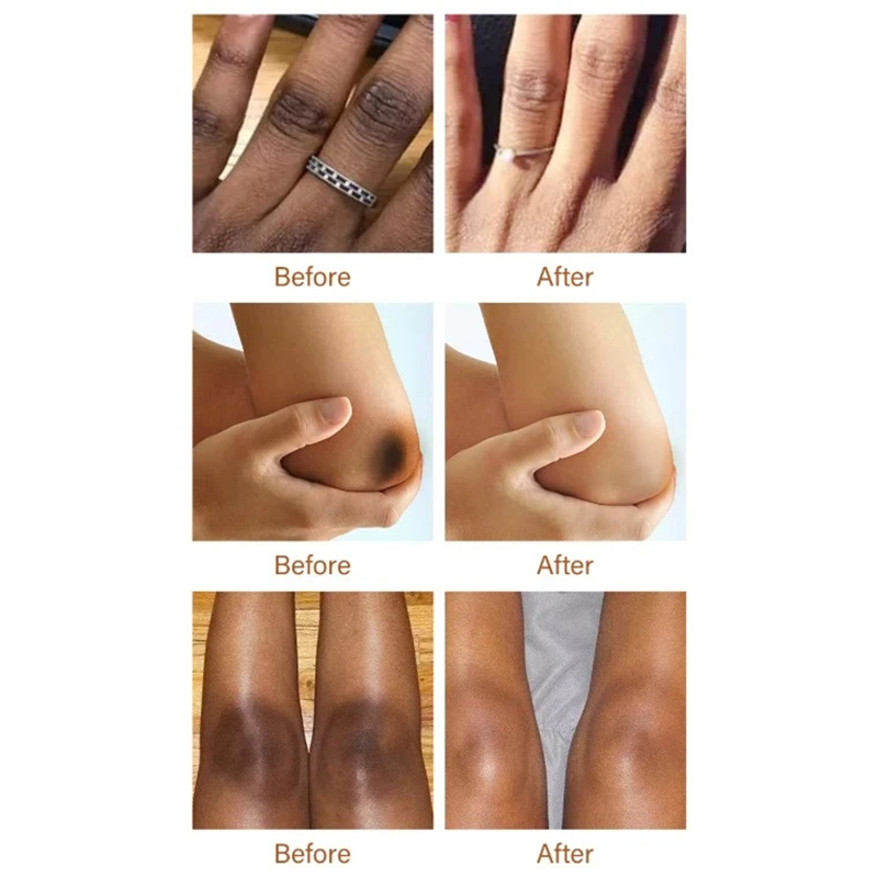 Picture of MOIKA Full Body Joint Whitening and Dark Spot Removal Serum 30ml