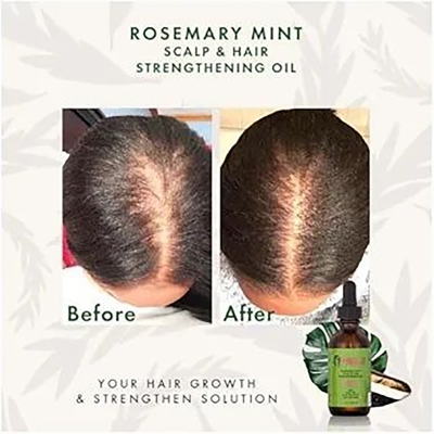 Picture of Mielle Organics Rosemary Mint Scalp & Hair Strengthening Oil 59ml