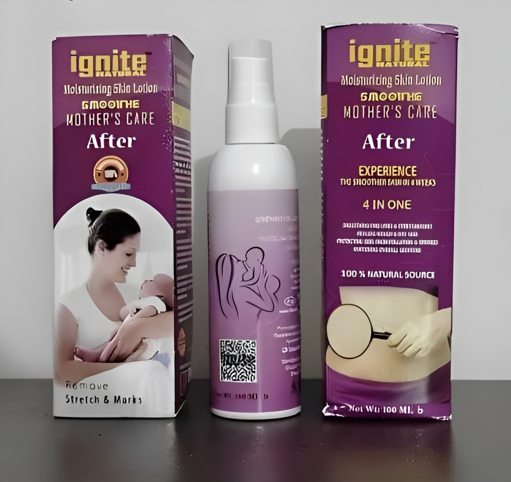 Picture of Mother's Care Moisturizing Body Lotion Remove Stretch & Marks 100ml