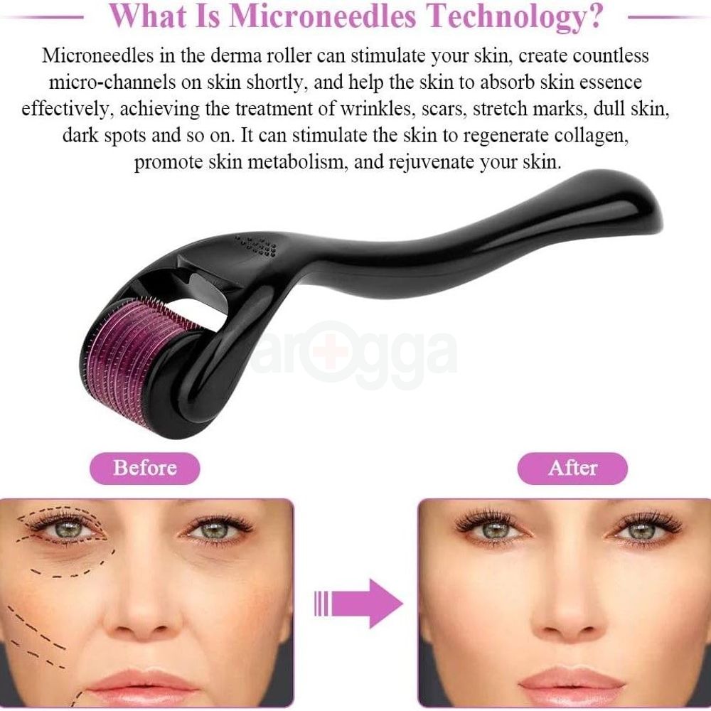 Picture of Derma Roller System 540 Needles Derma for Face and Skin Care - 0.75mm