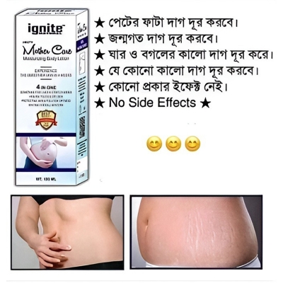 Picture of Natural Smooth Mother Care Moisturizing Body Lotion 250ML