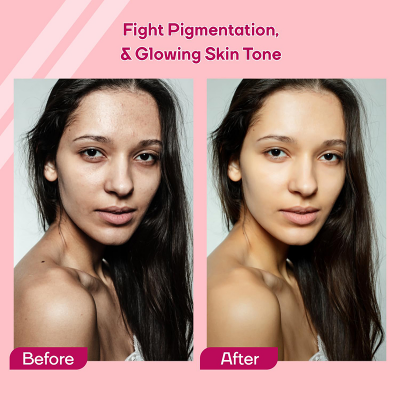 Picture of Anti pigmentation glowcin