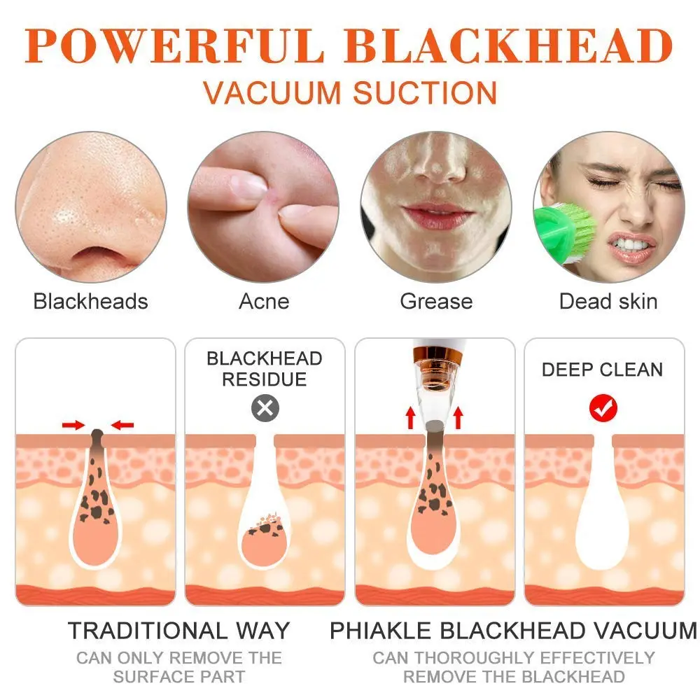 Picture of Blackhead Remover Facial Pore Vacuum Cleaner Electric Skin Care Pimple Extractor Cleaning Air Suction Machine Blackhead Remover Tool for Women and Men