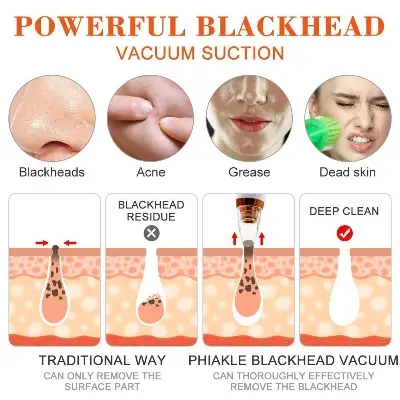 Picture of Blackhead Remover Facial Pore Vacuum Cleaner Electric Skin Care Pimple Extractor Cleaning Air Suction Machine Blackhead Remover Tool for Women and Men