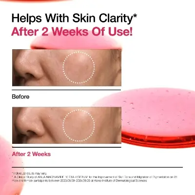 Picture of Anua Niacinamide 10 + TXA 4 Serum – Brightening & Dark Spot Care (30ml)