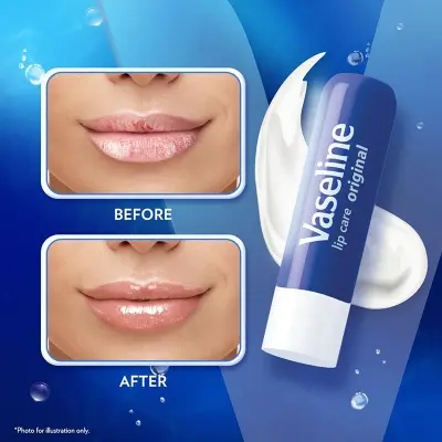 Picture of Vaseline Lip Therapy Original - 4.8 gm