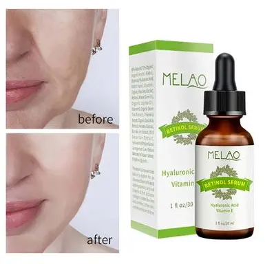 Picture of MELAO Retinol Serum