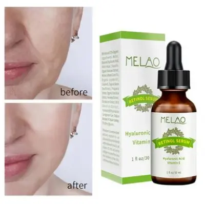 Picture of MELAO Retinol Serum
