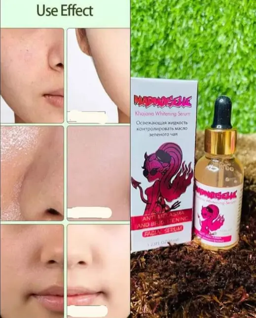 Picture of khajana whitening face serum