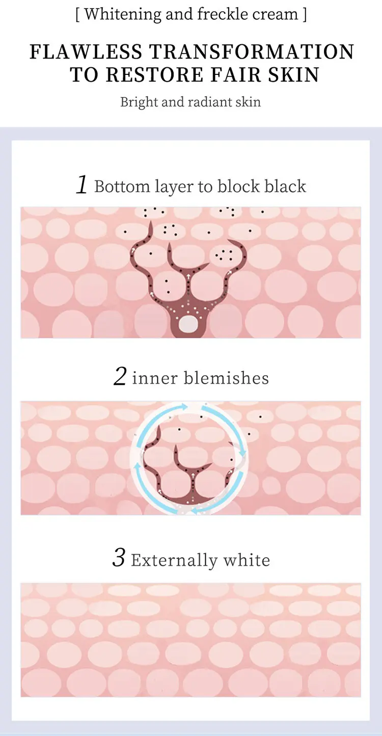 Picture of YOUBUY Whitening and Freckle Removing Cream