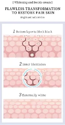 Picture of YOUBUY Whitening and Freckle Removing Cream