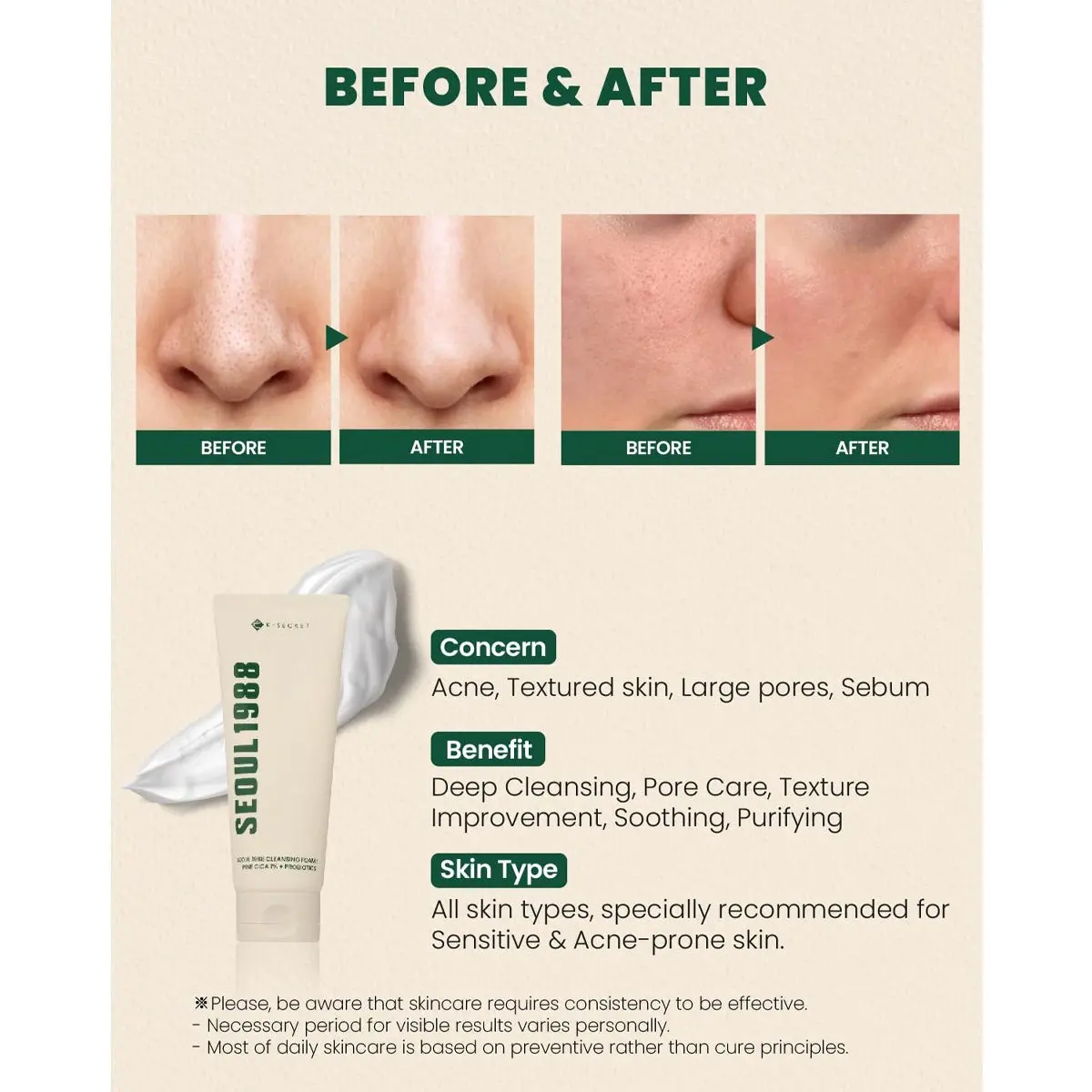 Picture of KSECRET SEOUL 1988 Cleansing Foam : Pine Cica 1% + Probiotics, 150ml/5.07fl.oz.