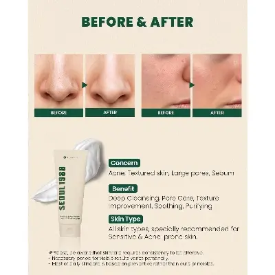 Picture of KSECRET SEOUL 1988 Cleansing Foam : Pine Cica 1% + Probiotics, 150ml/5.07fl.oz.