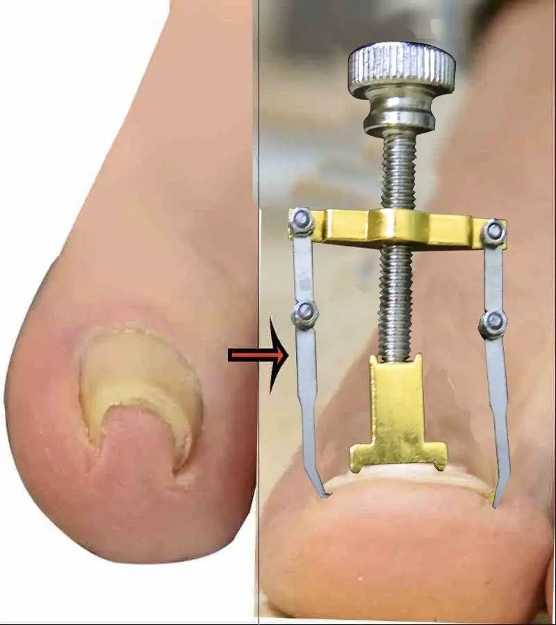 Picture of Nail Care Machine for Nail Repair Professional Salon Quality Manicure Pedicure Tool Kit Multicolor