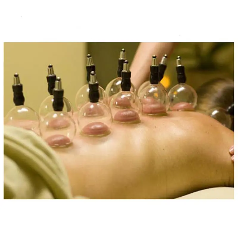Picture of Hijama Cupping Set Vacuum – 12pcs Dry Massage Cupping Therapy Set for Hijama Treatment