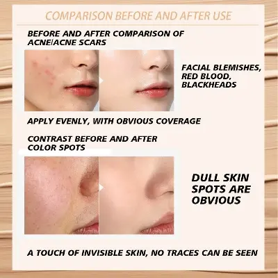 Picture of Sweet Mint Concealer Palette 3 Color Long lasting High Coverage concealer