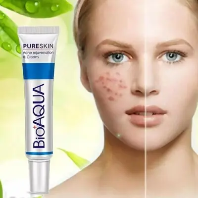 Picture of Bioaqua Pure Skin Acne Rejuvenation & Cream - 30g - acne care