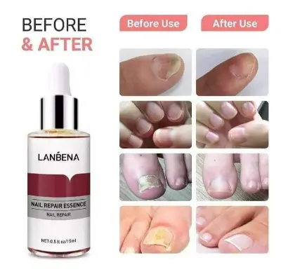 Picture of LANBENA Nail Repair Essence - 15ml