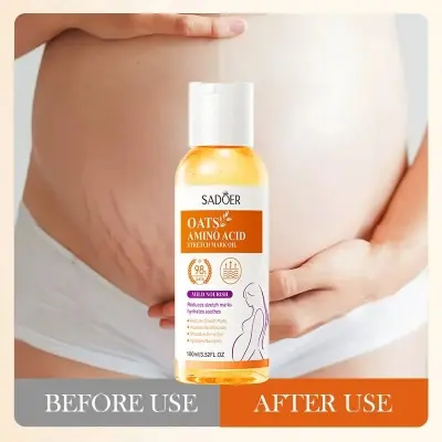 Picture of SADOER 98% Amino Acid Oats Essential Oil Fade Remove Stretch Mark Repair Smooth Massage Oil Serum for Pregnant Woman Skin Care - 15ml