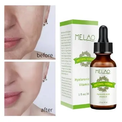 Picture of Melao Retinol Serum - Hyaluronic Acid Vitamin E-30ml