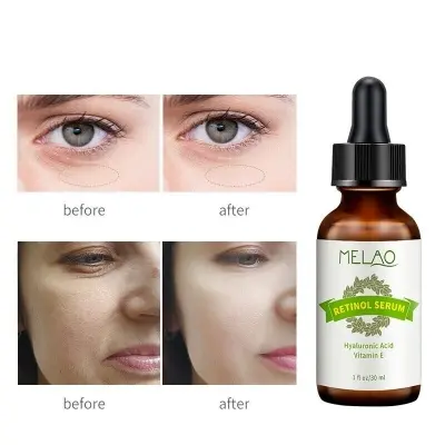 Picture of Melao Retinol Serum - Hyaluronic Acid Vitamin E-30ml