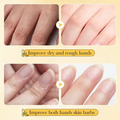 Picture of SADOER Anti-cracking Whitening Banana Nourishing Hand Cream  30g