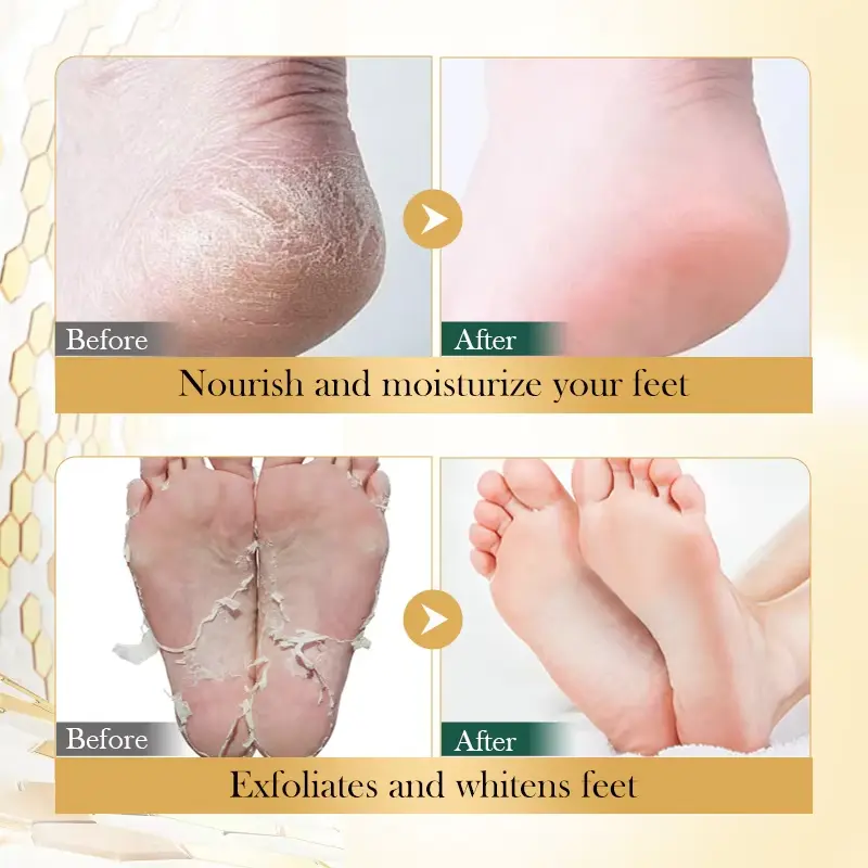 Picture of BIOAQUA Foot Peeling Vitamin E Manuka Honey Moisturizing Foot Mask