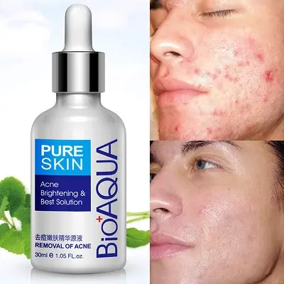 Picture of BIOAQUA Pure Skin Acne and Brightening and Best Solution Serum - 30ml