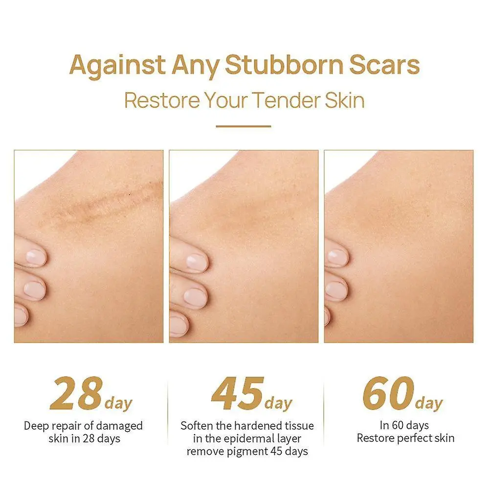 Picture of Lanbena - Tcm Scar And Acne Mark Removal Gel Ointment (30G) Acne Scar Cream