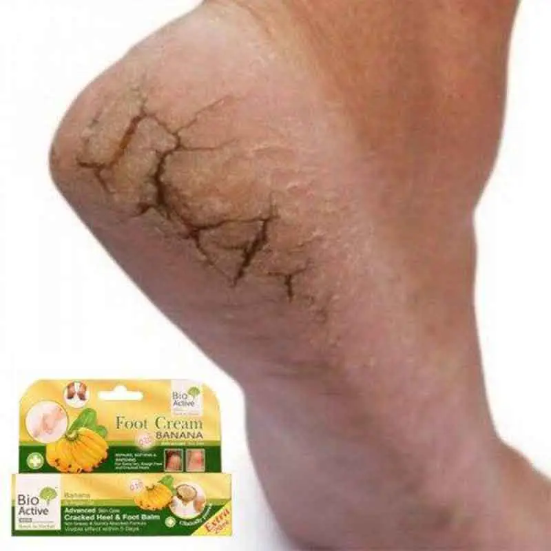 Picture of Bio Active Banana & Argan Oil Cracked Heel & Foot Balm - 30ml