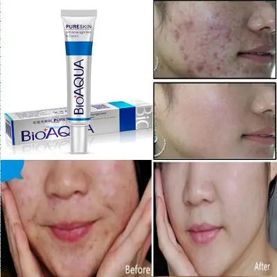 Picture of Bioaqua Pure Skin Acne Rejuvenation and Cream - 30g