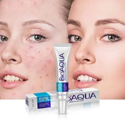 Picture of Bioaqua Pure Skin Acne Rejuvenation and Cream - 30g