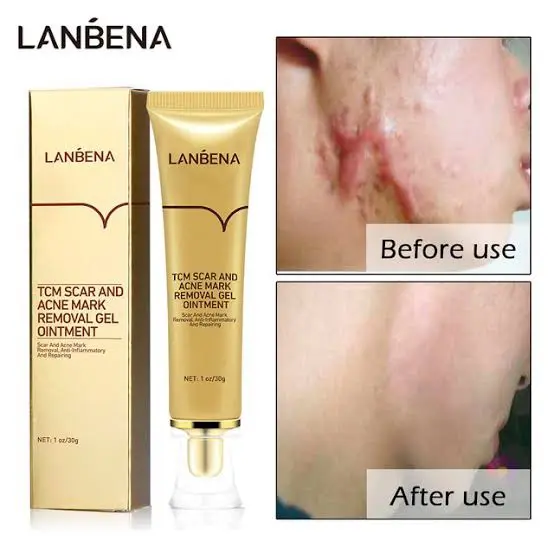 Picture of Lanbena - TCM Scar and Acne Mark Removal Gel Ointment - 30gm