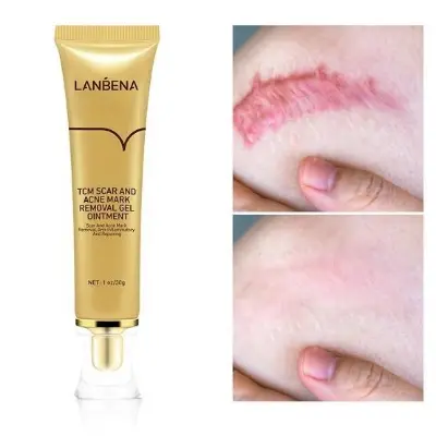 Picture of Lanbena - TCM Scar and Acne Mark Removal Gel Ointment - 30gm