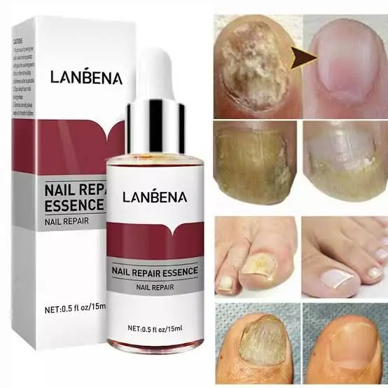 Picture of Lanbena Nail Repair Essence -15ml