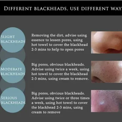 Picture of Bioaqua Bamboo Charcoal Purifying Peel-off Black Mask Blackhead Remover Acne Treatments Face Care Sunction Deep Cleansing - 60gm