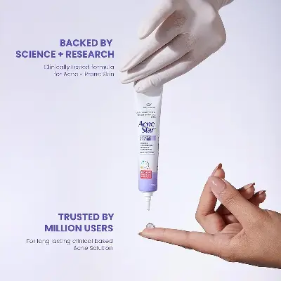 Picture of AcneStar Gel Cream For pimples - 22gm