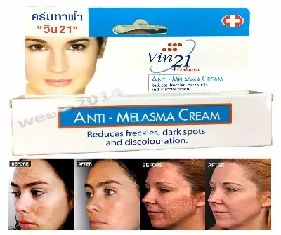 Picture of VINCERE ANTI-MELASMA CREAM - Help to fade freckles dark spots discoloration -15ml