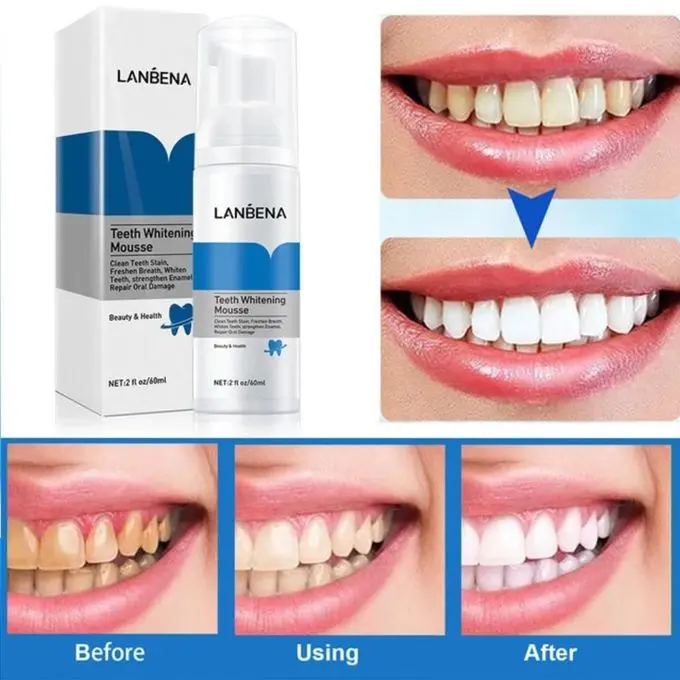 Picture of LANBENA TEETH WHITENING MOUSSE TOOTH WHITENING DENTAL TOOL CLEANING WHITE TEETH ORAL HYGIENE TOOTHPASTE BLEACHING REMOVE STAINS-60GM