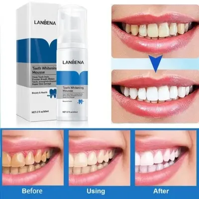 Picture of LANBENA TEETH WHITENING MOUSSE TOOTH WHITENING DENTAL TOOL CLEANING WHITE TEETH ORAL HYGIENE TOOTHPASTE BLEACHING REMOVE STAINS-60GM