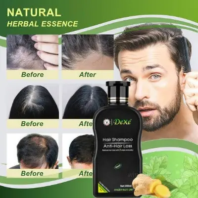 Picture of DEXE Anti-Hair Loss Hair Growth Shampoo Treatment Natural Ingredients 200ml