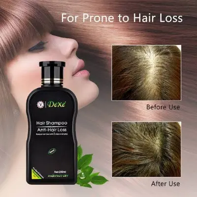 Picture of DEXE Anti-Hair Loss Hair Growth Shampoo Treatment Natural Ingredients 200ml