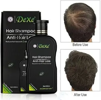Picture of Dexe Hair Shampoo Anti hair Loss Chinese Herbal Hair Growth For Men&Women-200ml