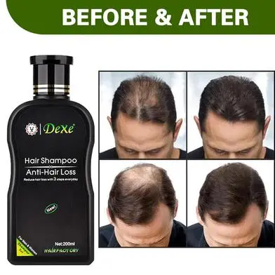 Picture of Dexe Hair Shampoo Anti hair Loss Chinese Herbal Hair Growth For Men&Women-200ml