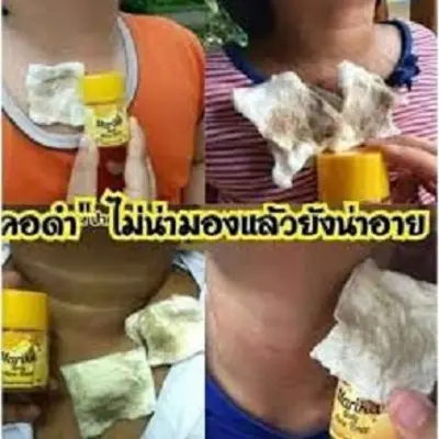 Picture of Marika Body Aura Toner Wipe Off The Stains Remove Scurf On body Skin -50ml