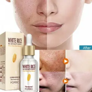 Picture of White Rice face Serum skin care -Wrinkles Dark Spots & anti-aging Sun Damage Corrector-15ml