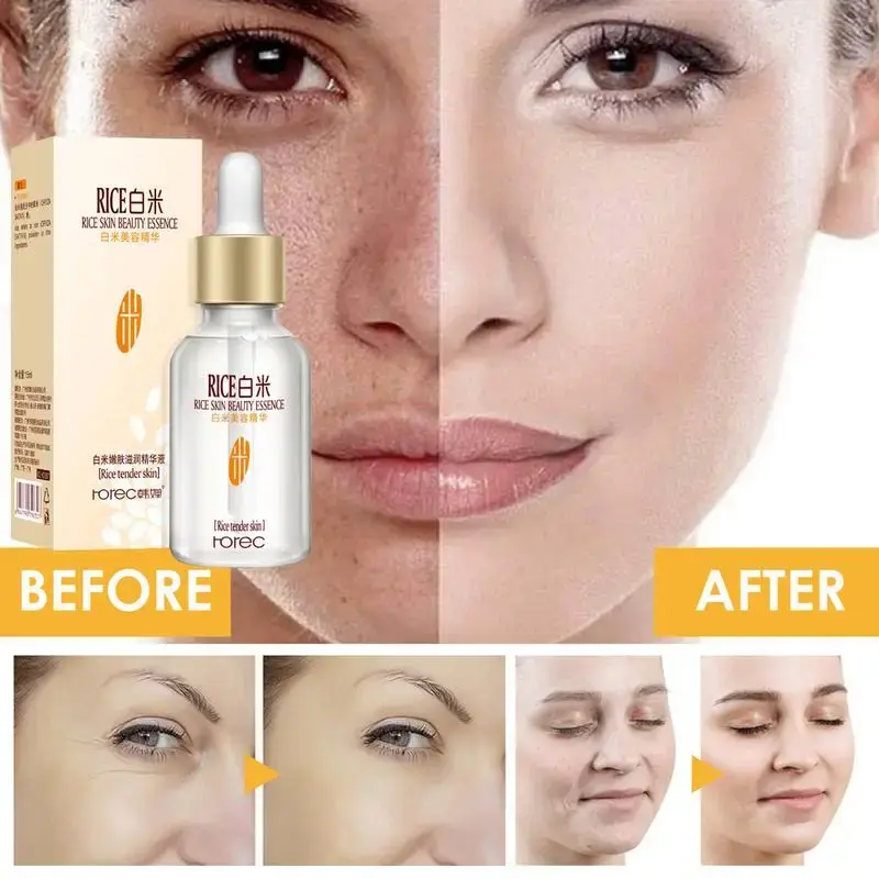 Picture of White Rice face Serum skin care -Wrinkles Dark Spots & anti-aging Sun Damage Corrector-15ml