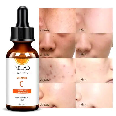 Picture of MELAO Vitamin C Hyaluronic Acid Shrink Pore Face Serum Moisturizing Essence Anti-Aging Anti-Oxidant Dry Skin Care-30ml