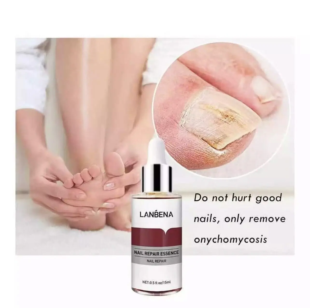 Picture of Lanbena Nail Fungal Treatment Remove Paronychia Onychomycosis Toe Nail Repairing,Treatment Toe Nail Repair Essence Nail Solution-15Ml